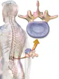 Anulus fibrosus