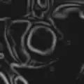 Gradient magnitude image